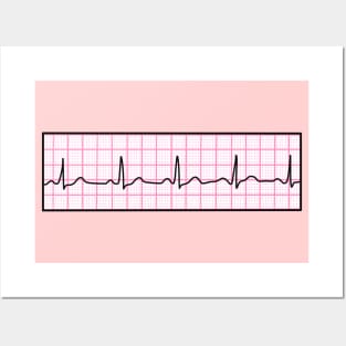 Hand Drawn Normal Electrocardiogram Pink Posters and Art